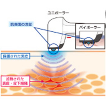 Thermo Shape （サーモシェイプ）