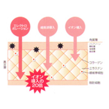 ELE-POLE （エレポレ）