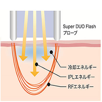 SUPER DUO FLASH　（スーパーデュオフラッシュ）